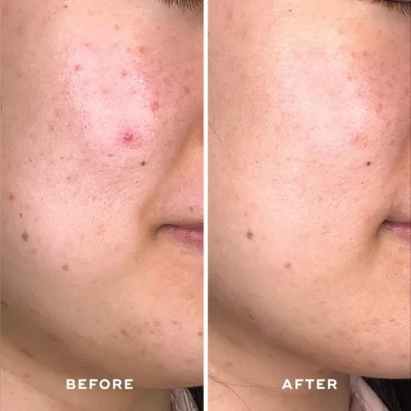 ACEOLOGY Detoxifying Treatment Mask 65 ml / 2.19 fl oz - Picture 6 of 13